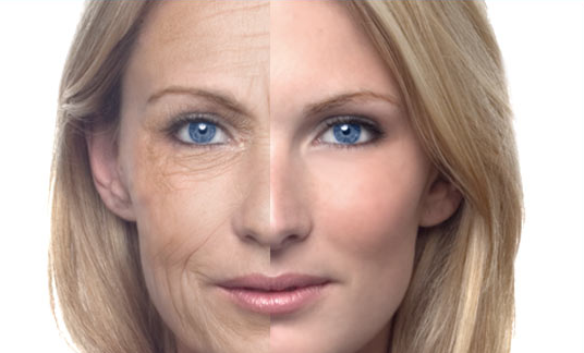 get-rid-of-wrinkles.jpg